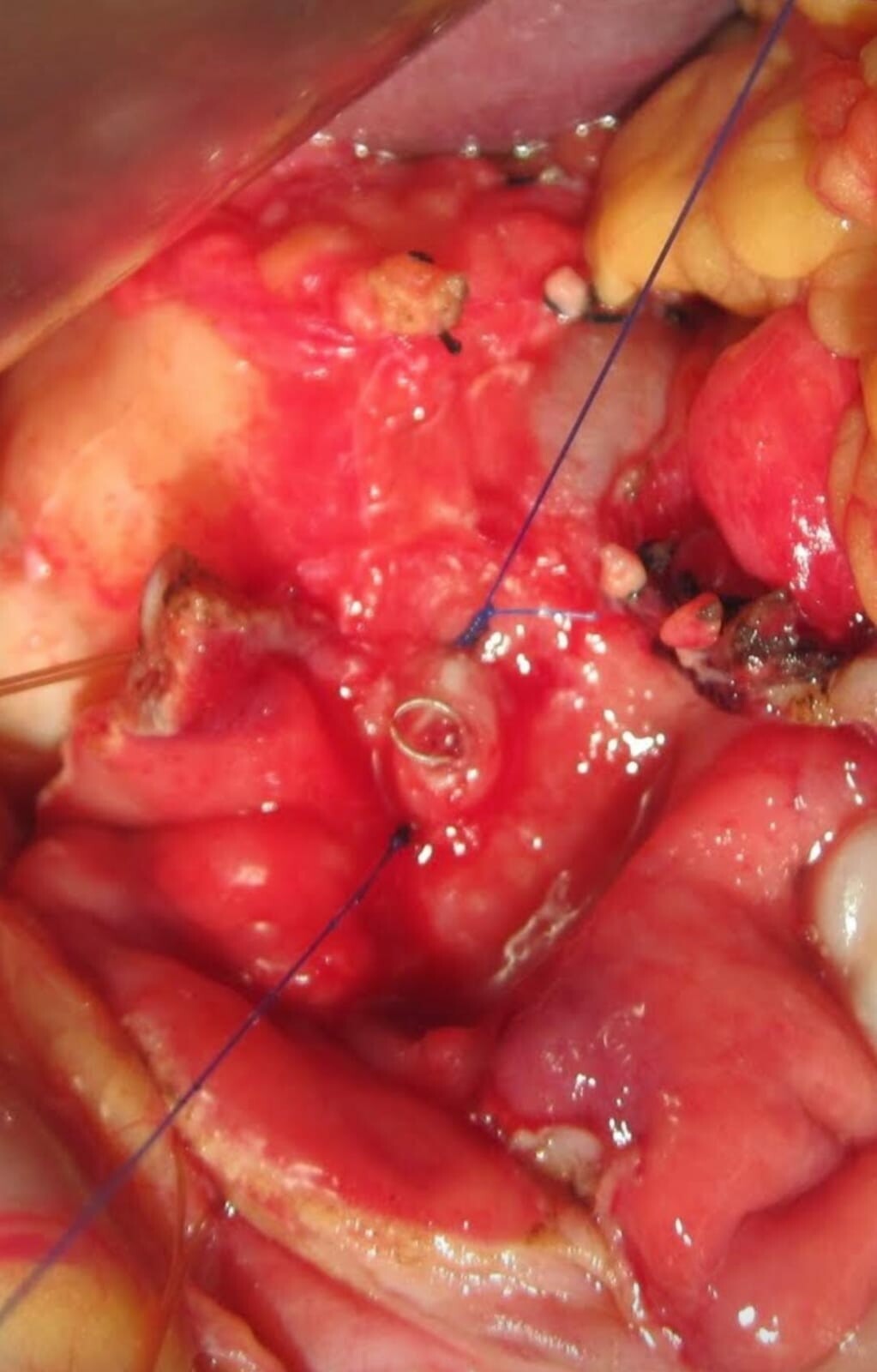 Liver and Pancreas clinic|Baner,Pune